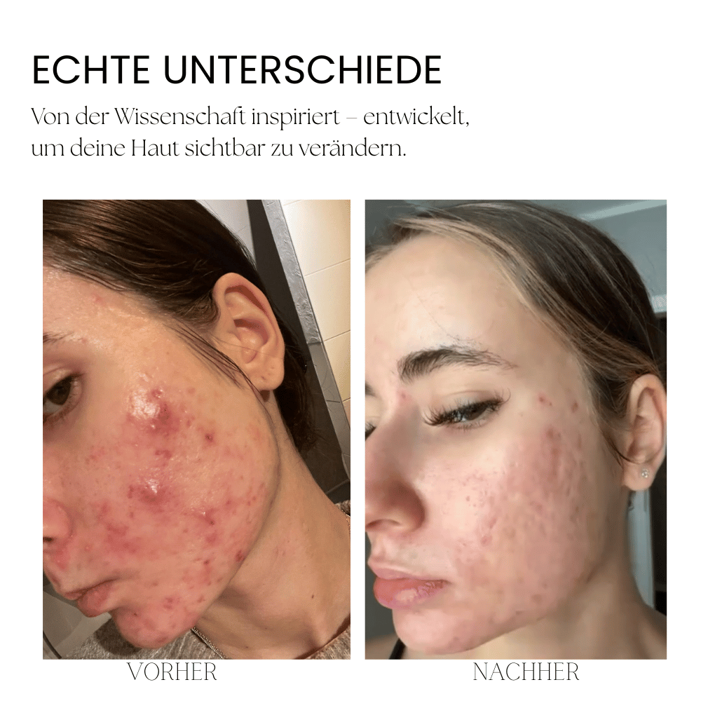 LumeaGlow- 7 Farben LED Maske