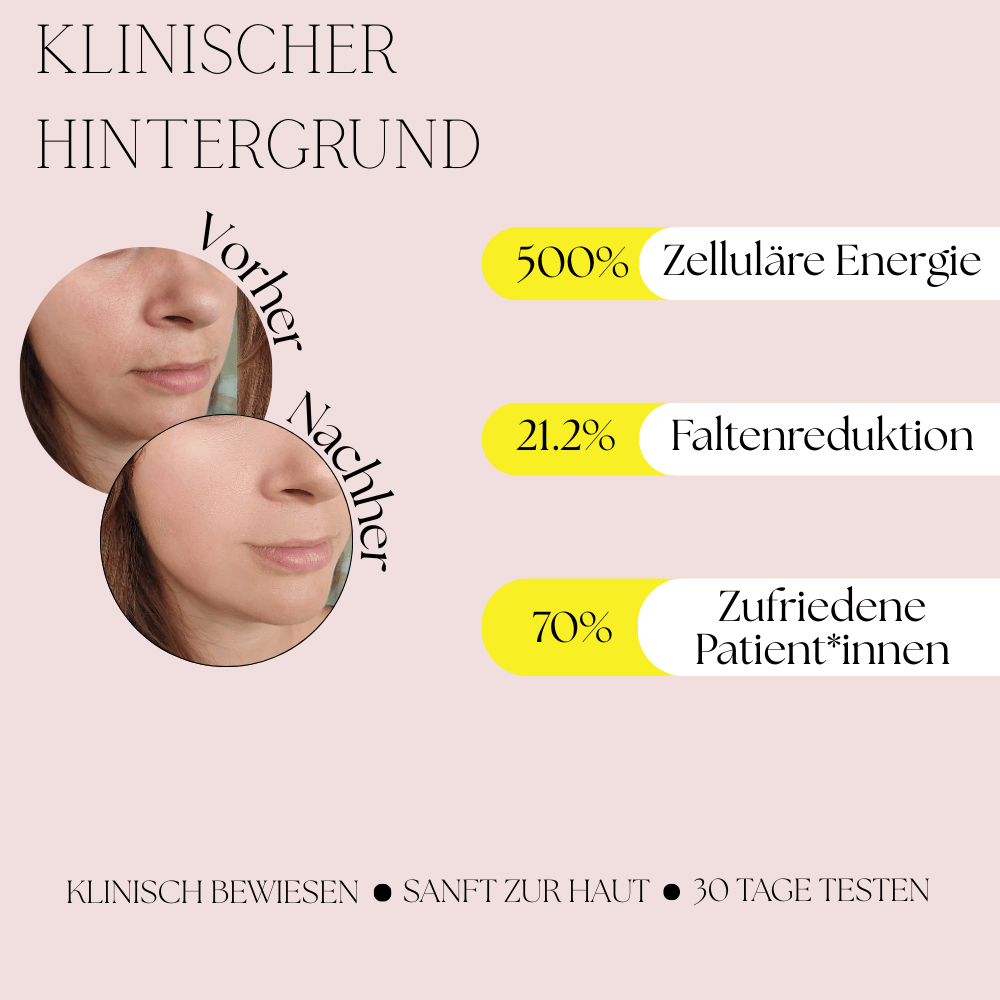 SkinGlow 7in1 EMS Lifting Tool – klinisch inspiriert. Sichtbare Faltenreduzierung um 21,2 %, 500 % mehr zelluläre Energie & 70 % zufriedene Patient*innen. Vorher-Nachher-Ergebnisse.