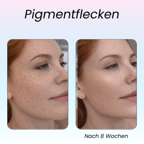 LumeaGlow- 7 Farben LED Maske