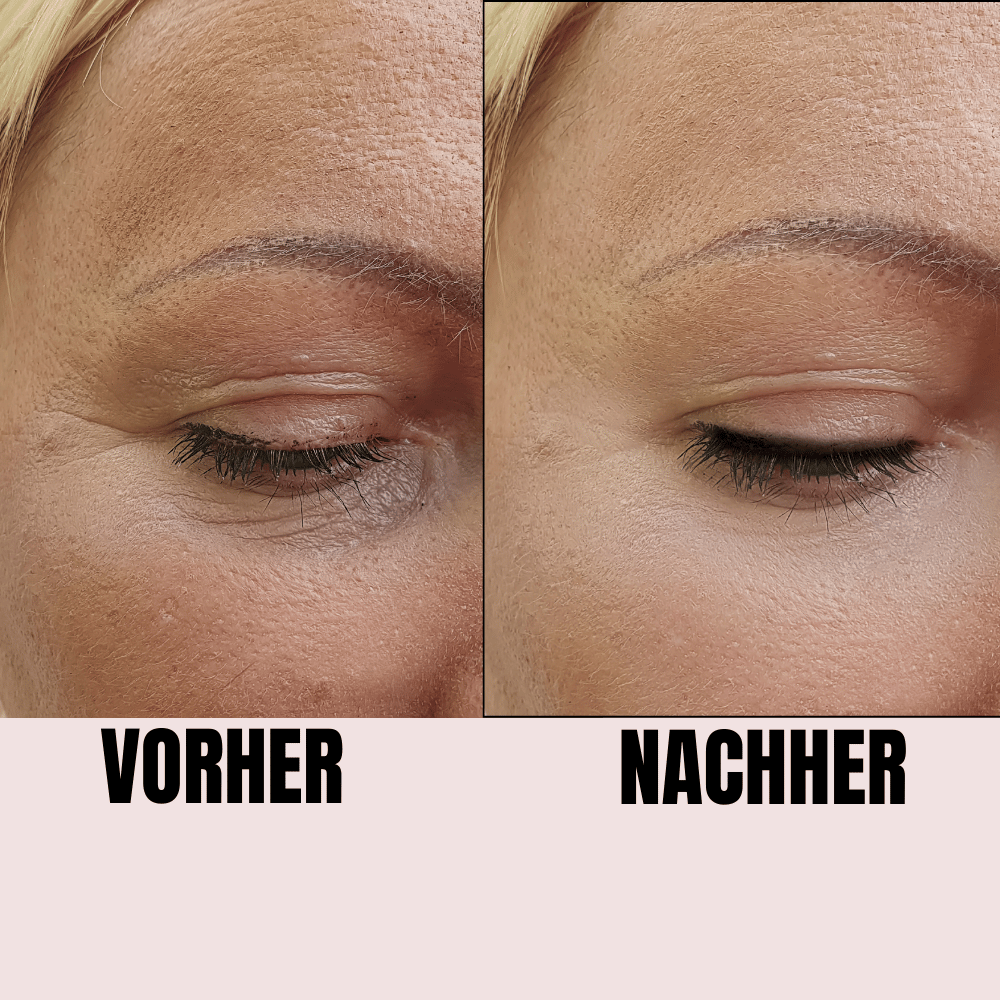 Vorher-Nachher Ergebnis mit GlowRitual Gua Sha Roller – sichtbar glattere Haut, reduzierte Fältchen & erfrischter Teint nach Gesichtsmassage